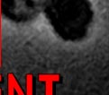 The Secret In The White Cell